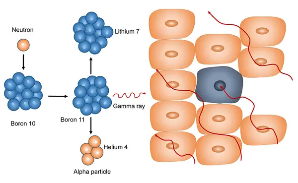 Principio fisico della Boron Neutron Capture Therapy © Wikipedia