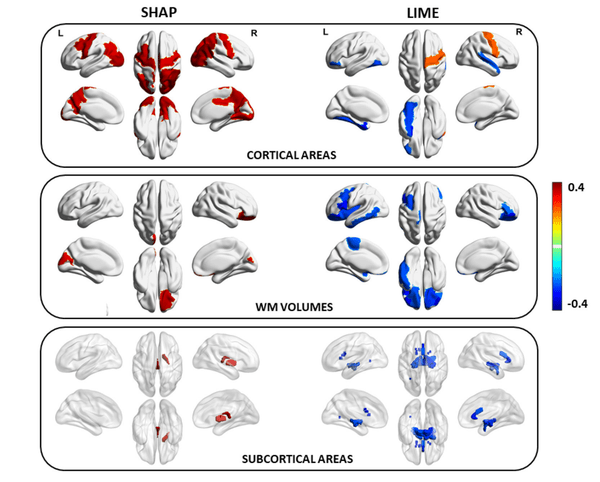 illustrazioni di aree corticali umane